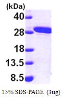 Human MMAB Protein (Recombinant His)