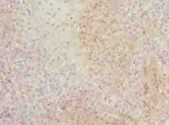 ITM2A Antibody (aa79-263)