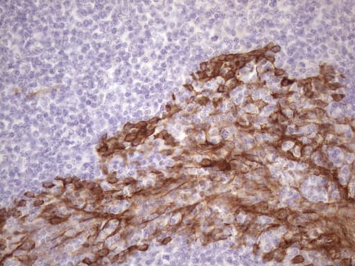 KRT16 / CK16 / Cytokeratin 16 Antibody (clone OTI1G5)