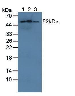 CYP21A2 Antibody (aa37-264)