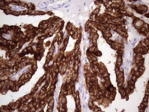 KRT16 / CK16 / Cytokeratin 16 Antibody (clone OTI1G5)