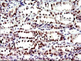 PMS2 Antibody (clone OTI2G5)