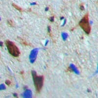 CAMK4 / CaMK IV Antibody (phospho-Thr200)