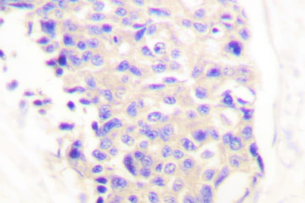 Polyclonal Rabbit anti-Human PLCG1 Antibody (Gly765, IHC, WB)