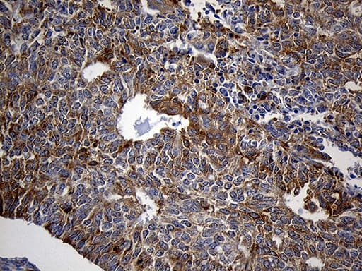 SH3BP1 Antibody (clone OTI1C9)