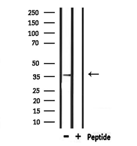 TAS2R9 Antibody