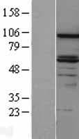 DAB2 Protein (Over-Expression Lysate Myc-DDK (Flag))