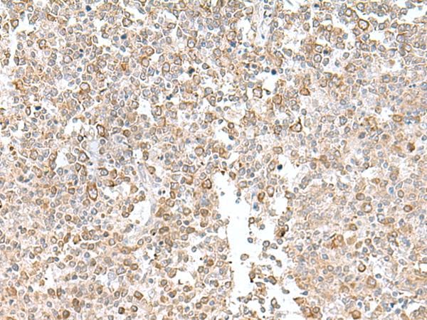 EIF1AY Antibody