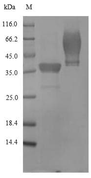 Staphylococcus aureus Gamma-hemolysin component B Protein (Recombinant 6His, N-terminus)