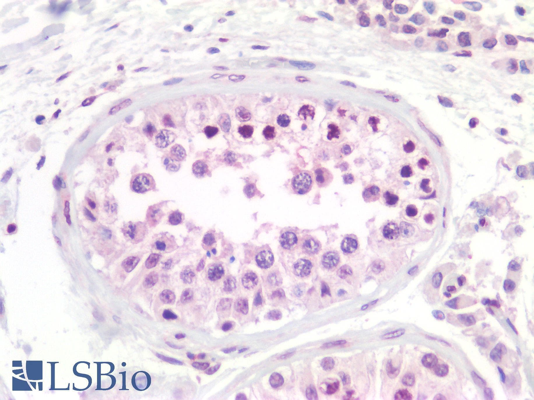 IHC-plus™ SF1 Antibody