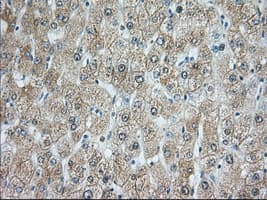 Monoclonal Mouse anti-Human RAB17 Antibody (clone OTI3A5, IHC, IF, WB)