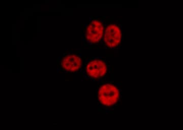 CTBP1 / CTBP Antibody