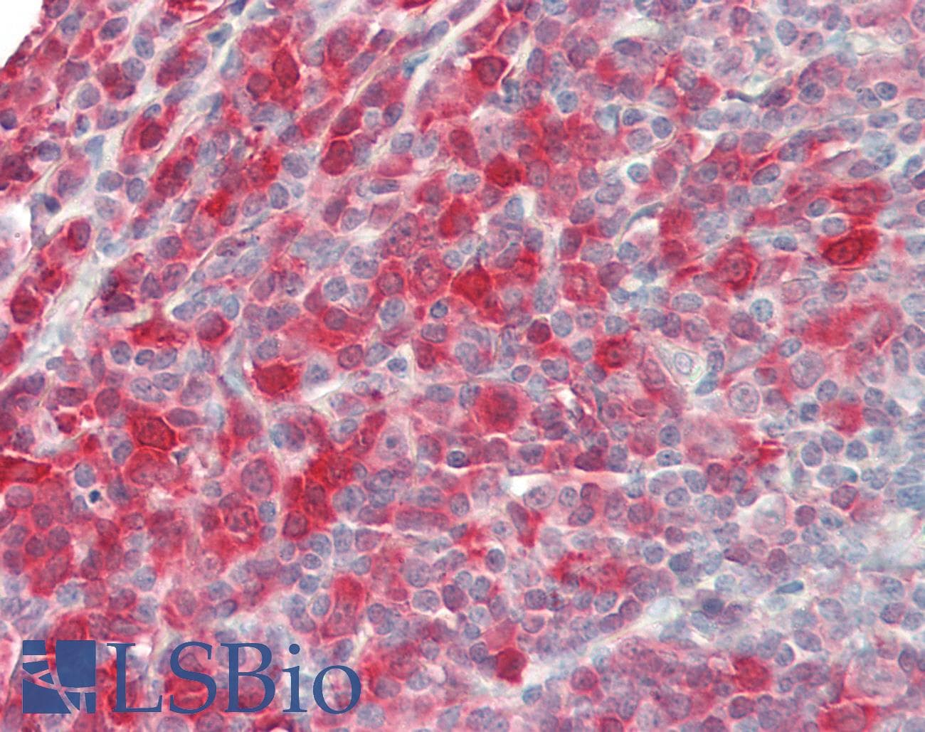 IHC-plus™ SYK Antibody (aa5-360, clone SYK-01)