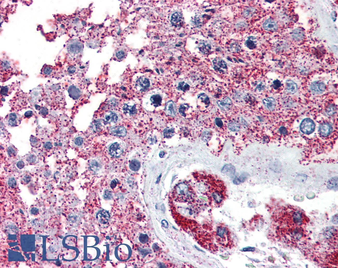 PathPlus™ NEK6 Antibody (N-Terminus)
