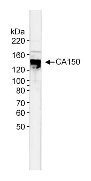 IHC-plus™ Polyclonal Rabbit anti-Human TCERG1 / CA150 Antibody (aa1-50, IHC, WB)