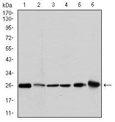 GSTM1 Antibody (clone 1H4F2)