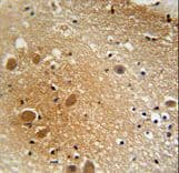 SPARCL1 / Hevin Antibody (aa208-236)