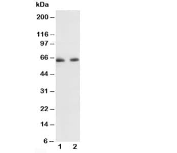 Polyclonal Rabbit anti-Human RELA / NFKB p65 Antibody (aa129-144, WB)