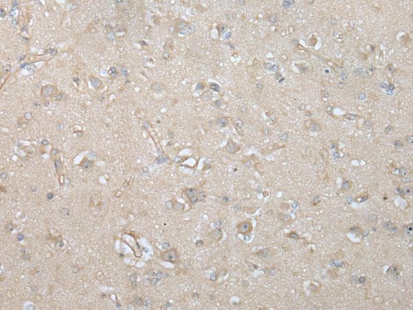 Polyclonal Rabbit anti-Human Villin-Like / VILL Antibody (IHC)