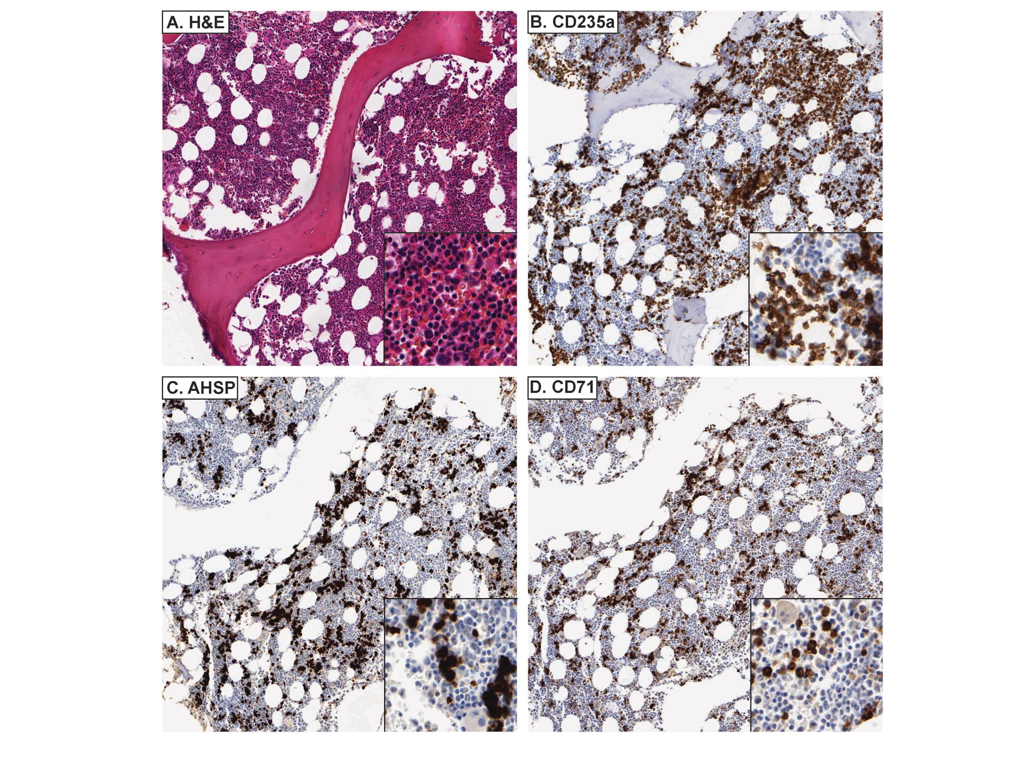 Polyclonal Rabbit anti-Human AHSP / EDRF Antibody (Lyophilized, IHC, WB)