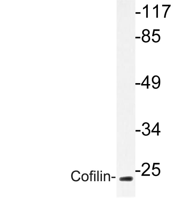 CFL1 / Cofilin Antibody (Met1)