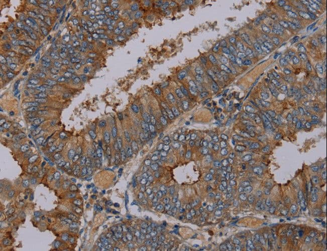 Polyclonal Rabbit anti-Human Peptide YY / PYY Antibody (IHC)