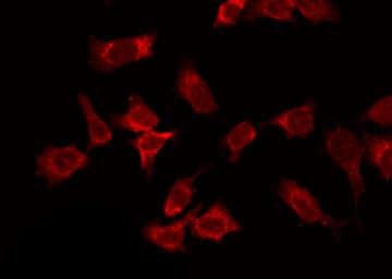 Polyclonal Rabbit anti-Human COL14A1 / Collagen XIV Antibody (IHC, IF, WB)