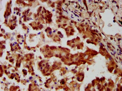 Polyclonal Rabbit anti-Human MBIP Antibody (IHC)