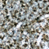 NCF1 / p47phox / p47 phox Antibody (C-Terminus)