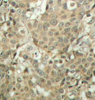 CFL1 / Cofilin Antibody (phospho-Ser3)