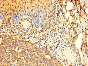 Polyclonal Rabbit anti-Human AAR2 Antibody