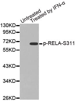RELA / NFKB p65 Antibody (phospho-Ser311)