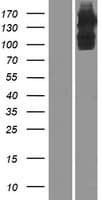 ULK4 Protein (Over-Expression Lysate Myc-DDK (Flag))
