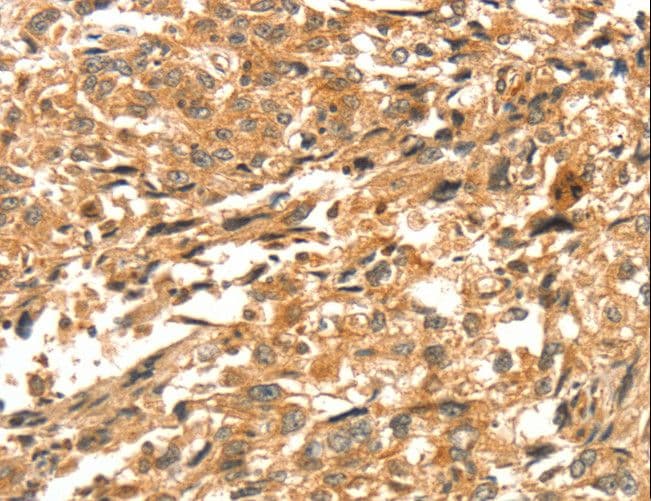Polyclonal Rabbit anti-Human GBTS1 / DIRAS1 Antibody (IHC)