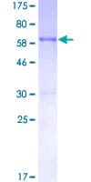 Human RP2 Protein (Recombinant GST)