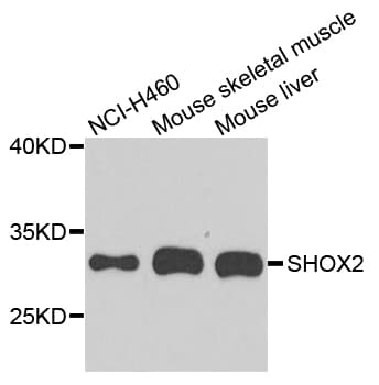 SHOX2 Antibody (aa96-355)