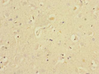 EAF2 / U19 Antibody