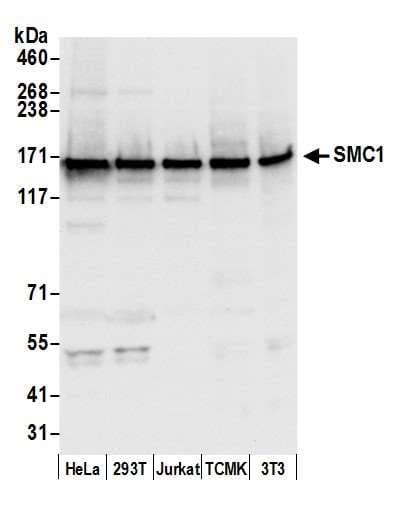 PathPlus™ SMC1A / SMC1 Antibody (aa1175-C-term)