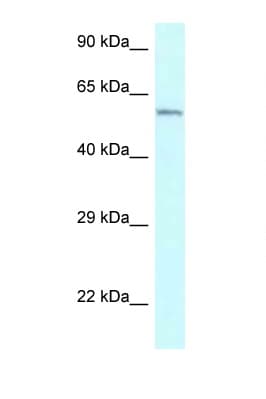 Polyclonal Rabbit anti-Human CYP2U1 Antibody (aa270-319, WB)