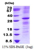 Human RHOV Protein (Recombinant His)
