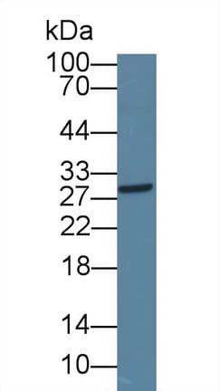 ICOS / CD278 Antibody (aa39-133)