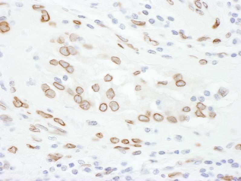 Polyclonal Rabbit anti-Human LMNA / Lamin A+C Antibody (aa550-600, IHC, WB)