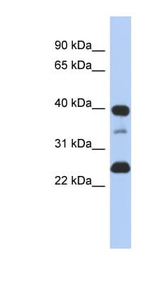 TMPO / TP / Thymopoietin Antibody (N-Terminus)
