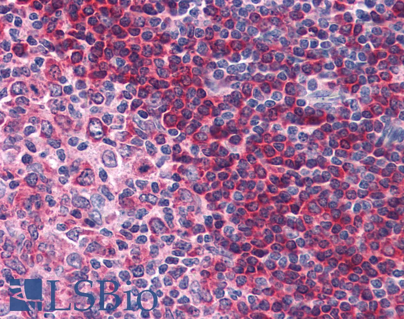 IHC-plus™ BTK Antibody