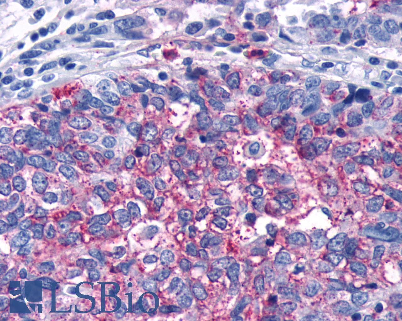 PathPlus™ FZD5 / Frizzled 5 Antibody (Cytoplasmic Domain)
