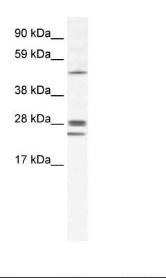 Polyclonal Rabbit anti-Human GJB2 / CX26 / Connexin 26 Antibody (FITC, aa85-134, WB)