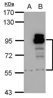 PDE4D Antibody (aa746-809)