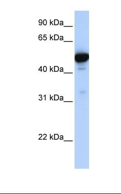 GLUD1/Glutamate Dehydrogenase Antibody (aa182-231)