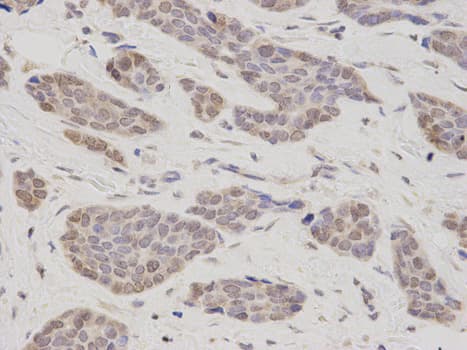 Polyclonal Rabbit anti-Human TMPO / TP / Thymopoietin Antibody (IHC, IF, WB)
