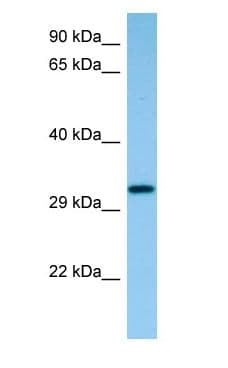 CAPZB / CAPZ Beta Antibody (C-Terminus)